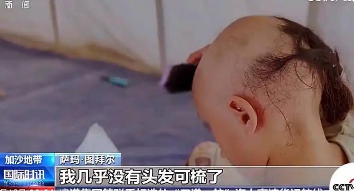 加沙8岁女孩逃难中几乎掉光头发